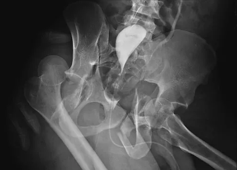 General Orthopedics 2026 Practice Questions: Set 3 (Solved) - Figure 6
