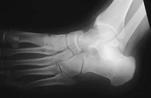 General Orthopedics 2026 Practice Questions: Set 3 (Solved) - Figure 65