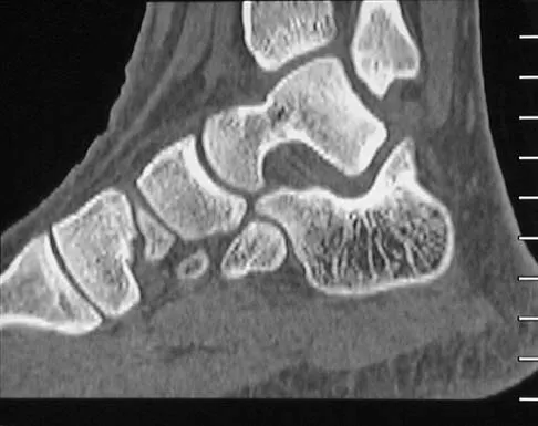 General Orthopedics 2026 Practice Questions: Set 3 (Solved) - Figure 66