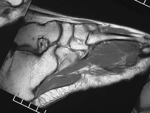 General Orthopedics 2026 Practice Questions: Set 3 (Solved) - Figure 67