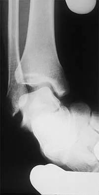 General Orthopedics 2026 Practice Questions: Set 3 (Solved) - Figure 72