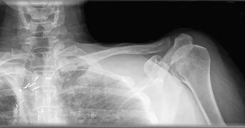 General Orthopedics 2026 Practice Questions: Set 3 (Solved) - Figure 75