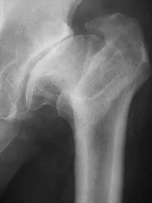 General Orthopedics 2026 Practice Questions: Set 3 (Solved) - Figure 80