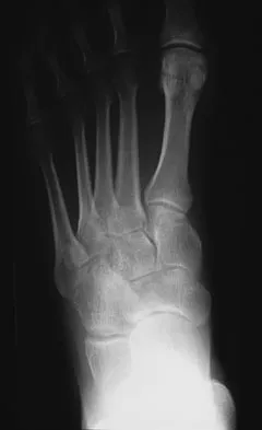 General Orthopedics 2026 Practice Questions: Set 3 (Solved) - Figure 88