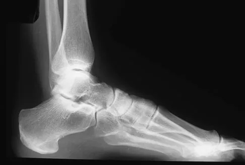 General Orthopedics 2026 Practice Questions: Set 3 (Solved) - Figure 89