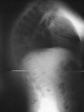 General Orthopedics 2026 Practice Questions: Set 3 (Solved) - Figure 93