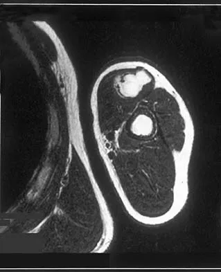General Orthopedics 2026 Practice Questions: Set 3 (Solved) - Figure 96