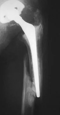 General Orthopedics 2026 Practice Questions: Set 3 (Solved) - Figure 99