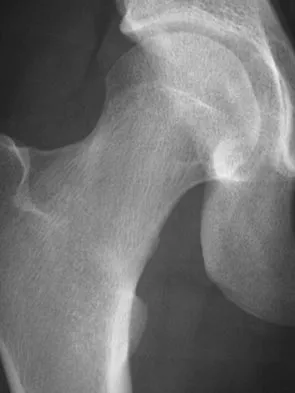 General Orthopedics Board Review 2026: High-Yield MCQs (Set 4) - Figure 17