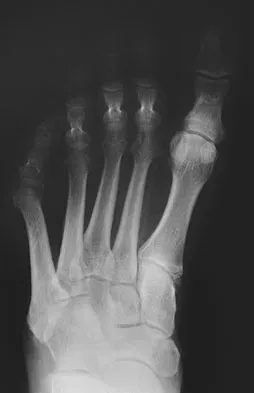 General Orthopedics Board Review 2026: High-Yield MCQs (Set 4) - Figure 18