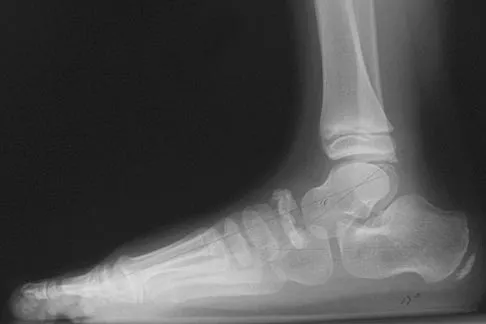 General Orthopedics Board Review 2026: High-Yield MCQs (Set 4) - Figure 20