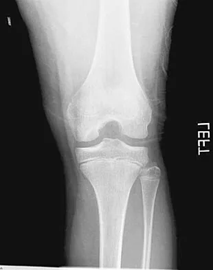 General Orthopedics Board Review 2026: High-Yield MCQs (Set 4) - Figure 33