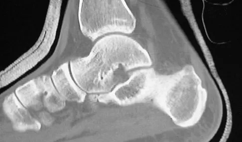 General Orthopedics Board Review 2026: High-Yield MCQs (Set 4) - Figure 38