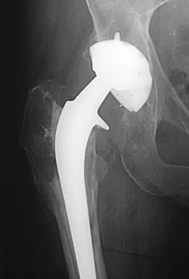 General Orthopedics Board Review 2026: High-Yield MCQs (Set 4) - Figure 40