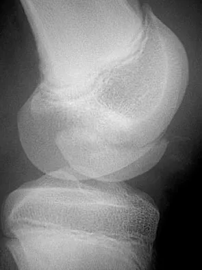 General Orthopedics Board Review 2026: High-Yield MCQs (Set 4) - Figure 45