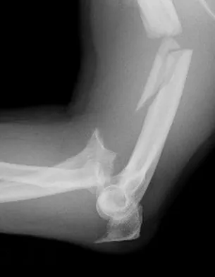 General Orthopedics Board Review 2026: High-Yield MCQs (Set 4) - Figure 47