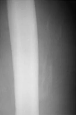 General Orthopedics Board Review 2026: High-Yield MCQs (Set 4) - Figure 50