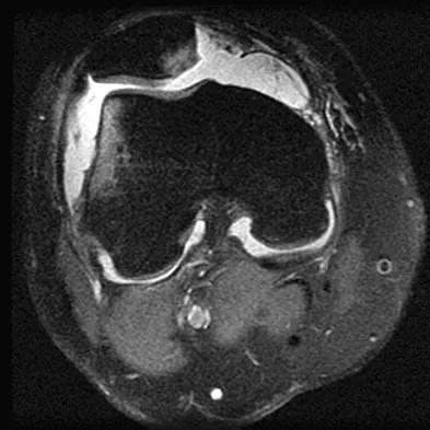 General Orthopedics Board Review 2026: High-Yield MCQs (Set 4) - Figure 51