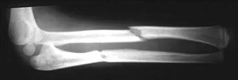 General Orthopedics Board Review 2026: High-Yield MCQs (Set 4) - Figure 56