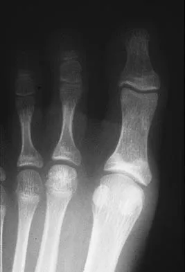 General Orthopedics Board Review 2026: High-Yield MCQs (Set 4) - Figure 66