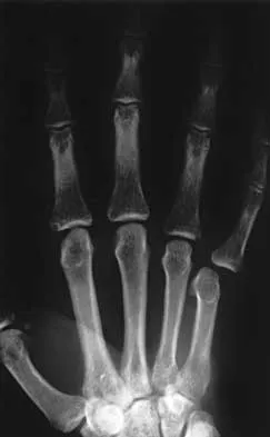 General Orthopedics Board Review 2026: High-Yield MCQs (Set 4) - Figure 68