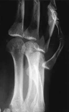 General Orthopedics Board Review 2026: High-Yield MCQs (Set 4) - Figure 69