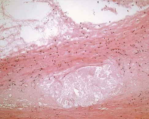 General Orthopedics Board Review 2026: High-Yield MCQs (Set 4) - Figure 72