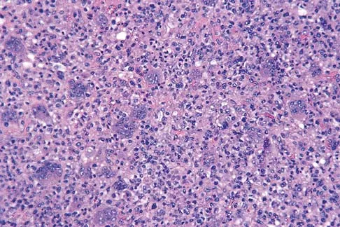 General Orthopedics Board Review 2026: High-Yield MCQs (Set 4) - Figure 77