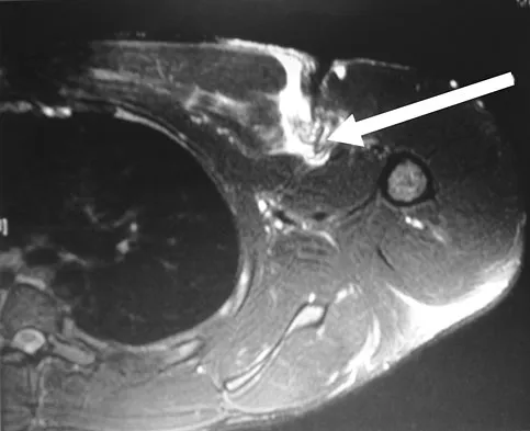General Orthopedics Board Review 2026: High-Yield MCQs (Set 4) - Figure 83
