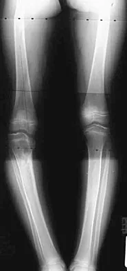 General Orthopedics Board Review 2026: High-Yield MCQs (Set 4) - Figure 86