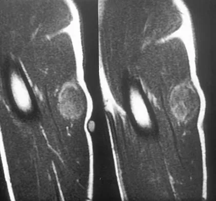 General Orthopedics Board Review 2026: High-Yield MCQs (Set 4) - Figure 88