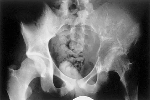 General Orthopedics Board Review 2026: High-Yield MCQs (Set 4) - Figure 89