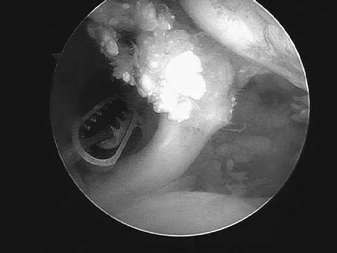General Orthopedics 2026 Practice Questions: Set 5 (Solved) - Figure 107