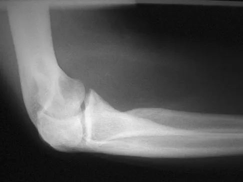 General Orthopedics 2026 Practice Questions: Set 5 (Solved) - Figure 109