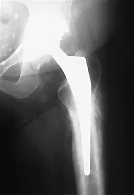 General Orthopedics 2026 Practice Questions: Set 5 (Solved) - Figure 110