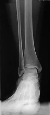 General Orthopedics 2026 Practice Questions: Set 5 (Solved) - Figure 14