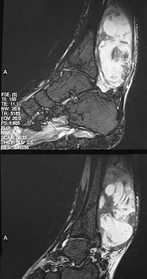General Orthopedics 2026 Practice Questions: Set 5 (Solved) - Figure 17