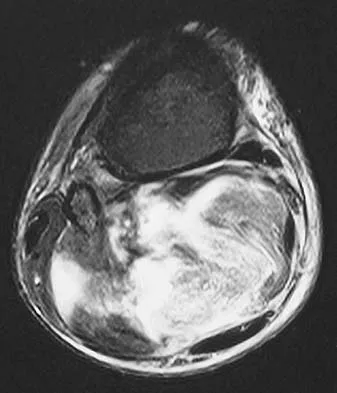 General Orthopedics 2026 Practice Questions: Set 5 (Solved) - Figure 18