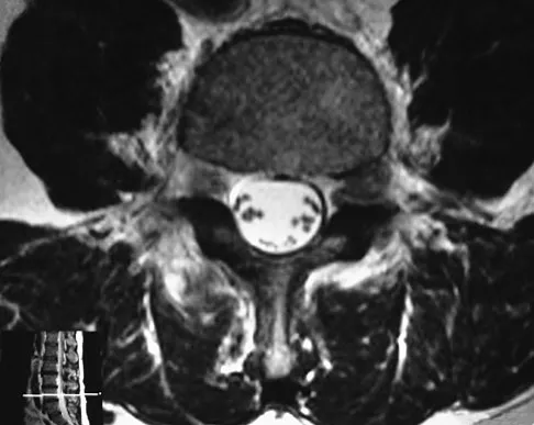 Click to enlarge General Orthopedics 2026 Practice Questions: Set 5 (Solved) - Figure 2