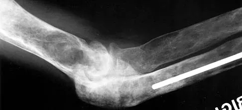 General Orthopedics 2026 Practice Questions: Set 5 (Solved) - Figure 23