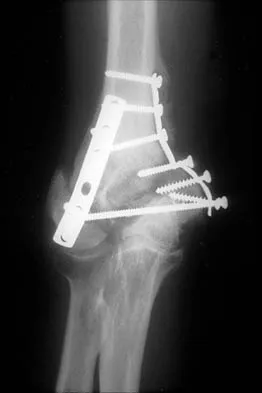 General Orthopedics 2026 Practice Questions: Set 5 (Solved) - Figure 25