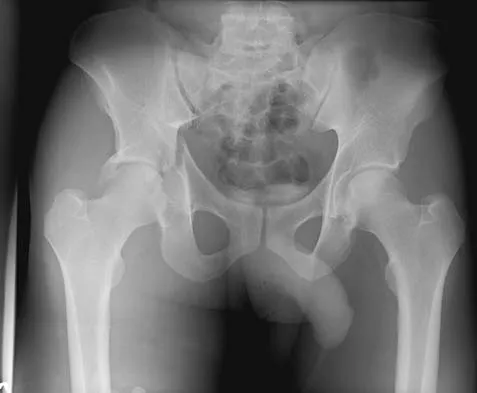 General Orthopedics 2026 Practice Questions: Set 5 (Solved) - Figure 29