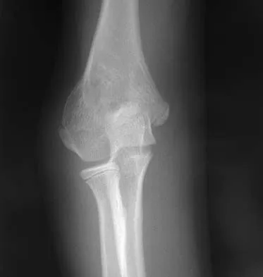 General Orthopedics 2026 Practice Questions: Set 5 (Solved) - Figure 3