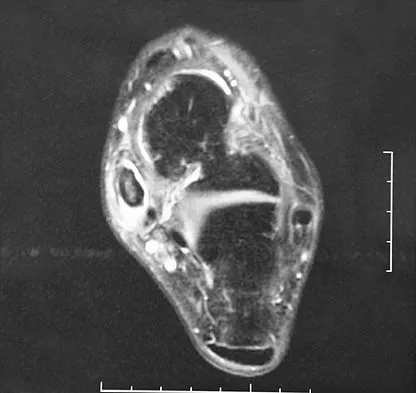 General Orthopedics 2026 Practice Questions: Set 5 (Solved) - Figure 31