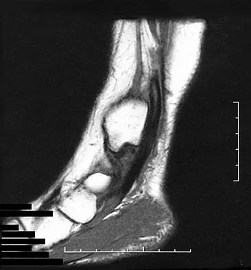 General Orthopedics 2026 Practice Questions: Set 5 (Solved) - Figure 32