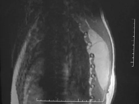 General Orthopedics 2026 Practice Questions: Set 5 (Solved) - Figure 33