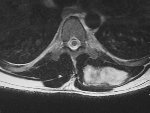 General Orthopedics 2026 Practice Questions: Set 5 (Solved) - Figure 34