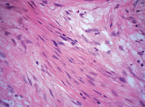 General Orthopedics 2026 Practice Questions: Set 5 (Solved) - Figure 37