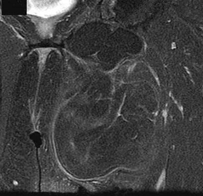 General Orthopedics 2026 Practice Questions: Set 5 (Solved) - Figure 47