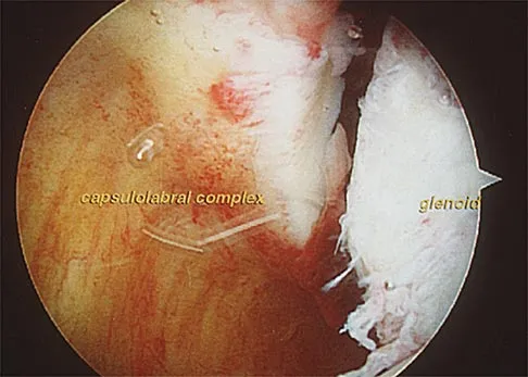 General Orthopedics 2026 Practice Questions: Set 5 (Solved) - Figure 48